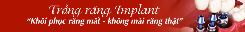Răng đẹp hết ý - Không lo chi phí