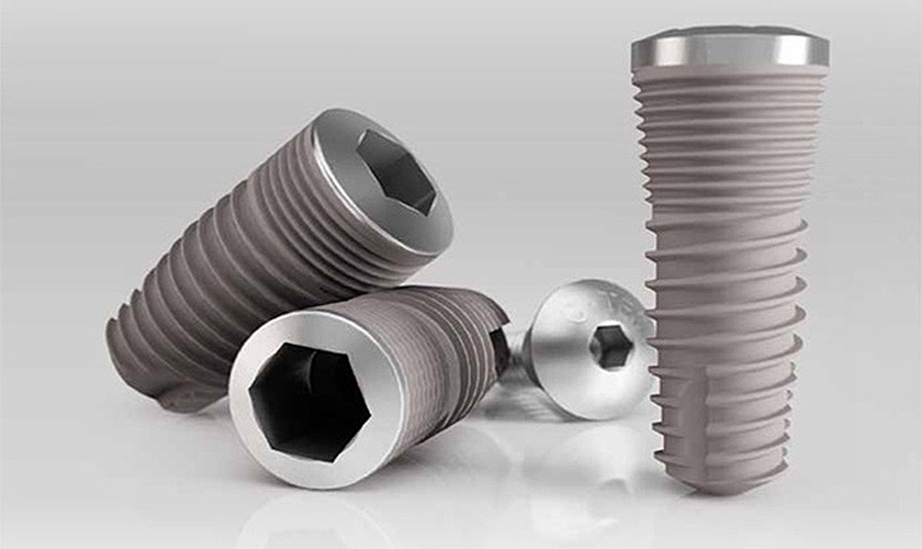 Ưu điểm của trồng răng Implant răng cửa đó là khả năng chịu lực tốt như răng thật, tự nhiên như răng thật mọc từ nướu